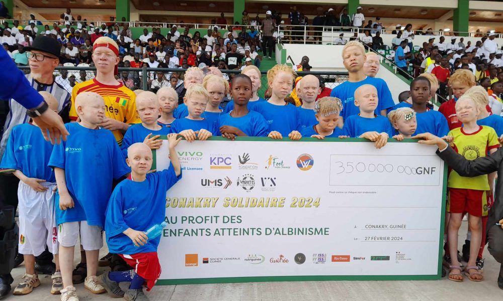 Gala in favor of Guinean albinos: more than 500 million GNF raised in Conakry